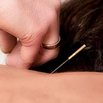 Akkupunktur, TCM-Praxis, TCM