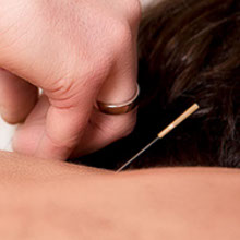 Akkupunktur, TCM-Praxis, TCM